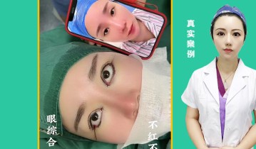 眼综合四项