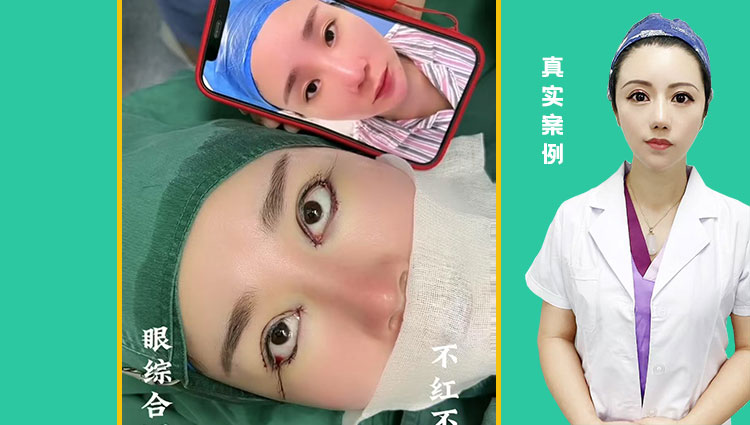 眼综合四项